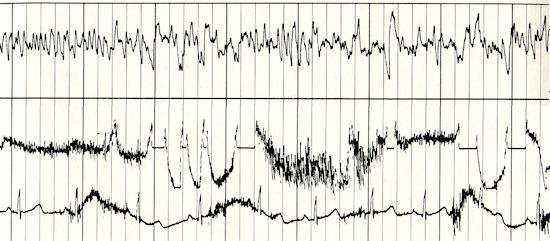 A sampling of Ann Druyan's brain waves, recorded on June 3, 1977. 